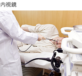 内視鏡
